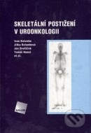 Skeletální postižení v uroonkologii - cena, porovnanie