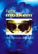 Řezy mozkem - cena, porovnanie