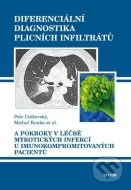 Diferenciální diagnostika plicních infiltrátů - cena, porovnanie