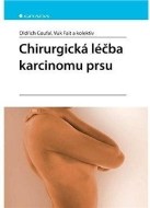 Chirurgická léčba karcinomu prsu - cena, porovnanie