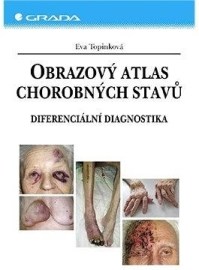 Obrazový atlas chorobných stavů