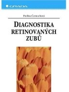 Diagnostika retinovaných zubů - cena, porovnanie