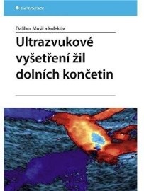 Ultrazvukové vyšetření žil dolních končetin