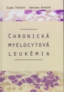 Chronická myelocytová leukémia - cena, porovnanie