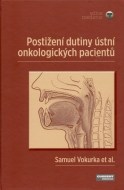 Postižení dutiny ústní onkologických pacientů - cena, porovnanie