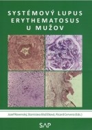 Systémový lupus erythematosus u mužov - cena, porovnanie