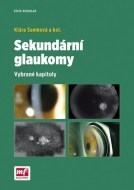 Sekundární glaukomy - cena, porovnanie