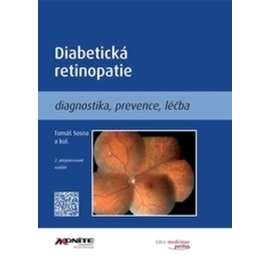 Diabetická retinopatie