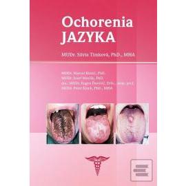 Ochorenia jazyka