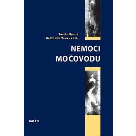 Nemoci močovodu