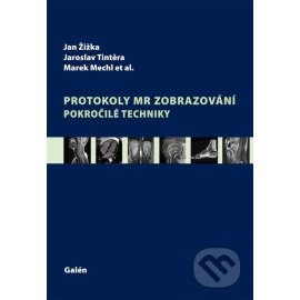 Protokoly MR zobrazování. Pokročilé techniky