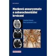 Mozková aneurysmata a subarachnoidální krvácení - cena, porovnanie