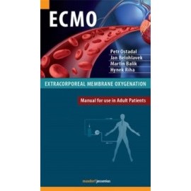 ECMO Extracorporeal membrane oxygenation