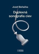 Duplexná sonografia ciev - cena, porovnanie