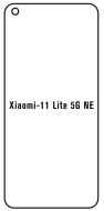 Hydrogel  Ochranná fólia Xiaomi 11 Lite 5G NE - predná matná - cena, porovnanie