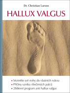 Hallux valgus - cena, porovnanie