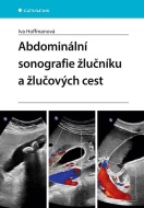 Abdominální sonografie žlučníku a žlučových cest - cena, porovnanie