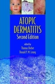 Atopic Dermatitis